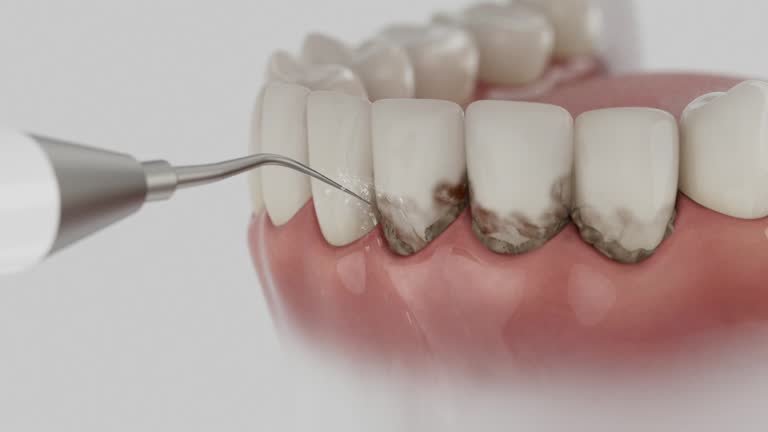 Trusted Teeth Cleaning And Checkup service in East Liverpool, OH - Dentist Open Now